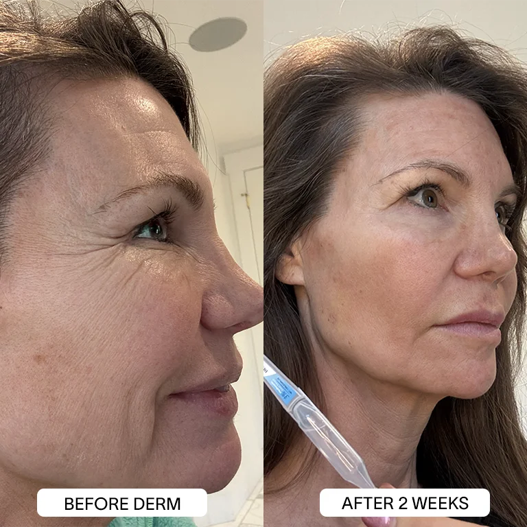 6x Derm 3% Hyaluronic Acid Serum - Image 14