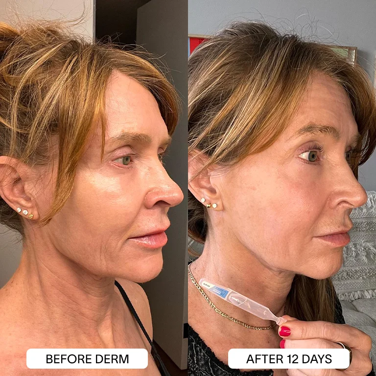 6x Derm 3% Hyaluronic Acid Serum - Image 15