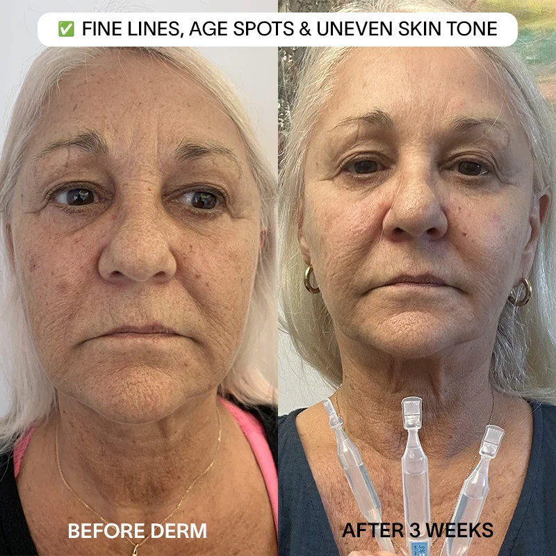 6x Derm 3% Hyaluronic Acid Serum - Image 5