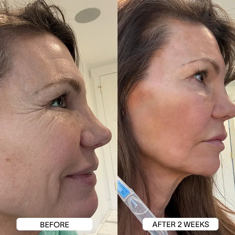 THE DRM LAB 3% Hyaluronic Acid Serum - Image 15
