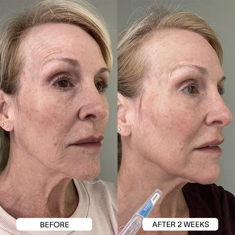 THE DRM LAB 3% Hyaluronic Acid Serum - Image 13
