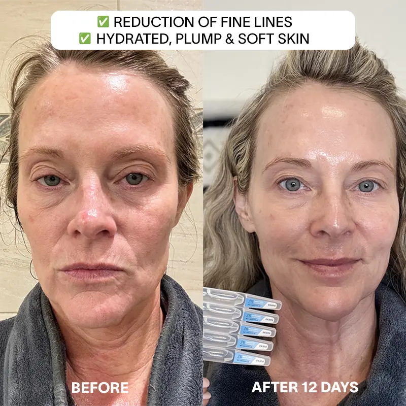 THE DRM LAB 3% Hyaluronic Acid Serum - Image 4