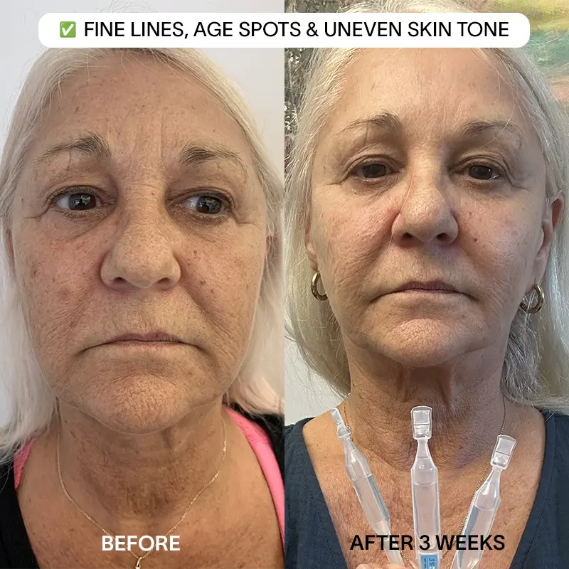 THE DRM LAB 3% Hyaluronic Acid Serum - Image 5