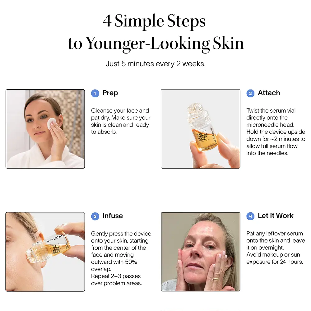PDRN Micro Infusion Treatment - Image 7