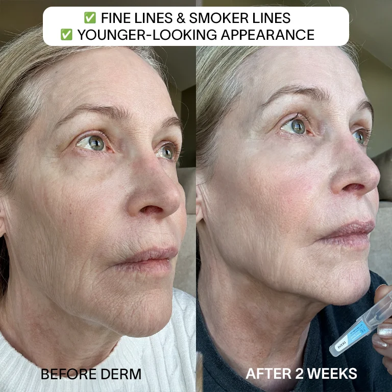 Derm Perfect Trio - Image 3